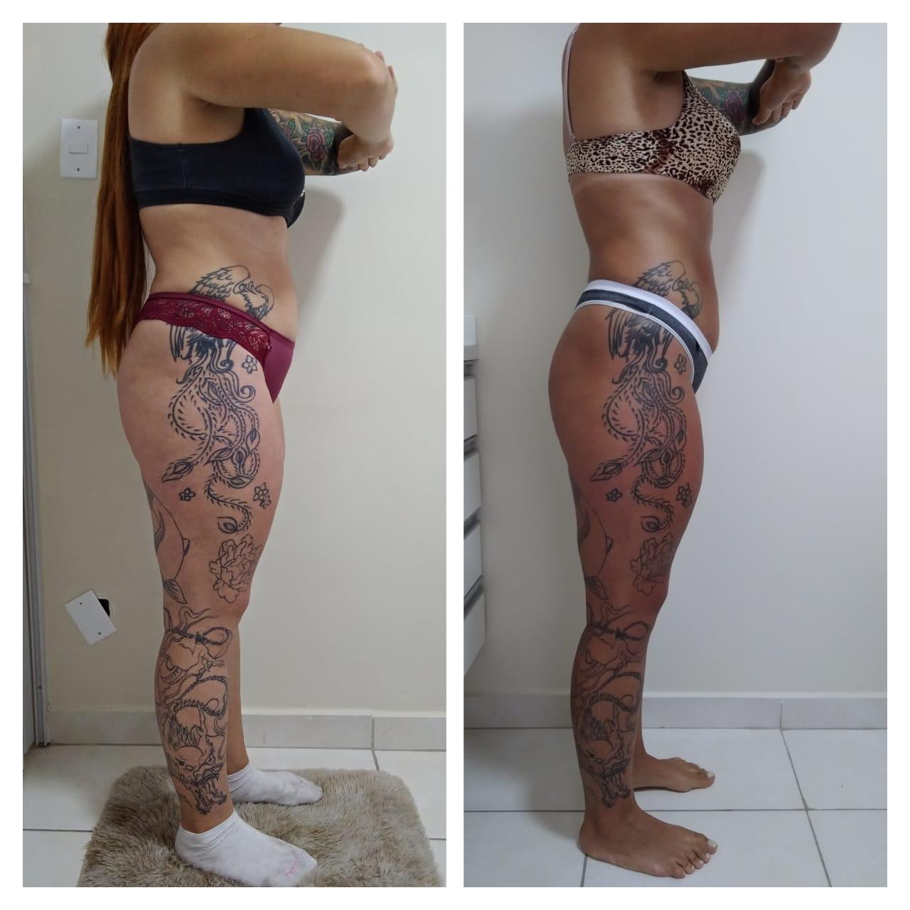 Antes e depois — Tonificação de glúteos e pernas