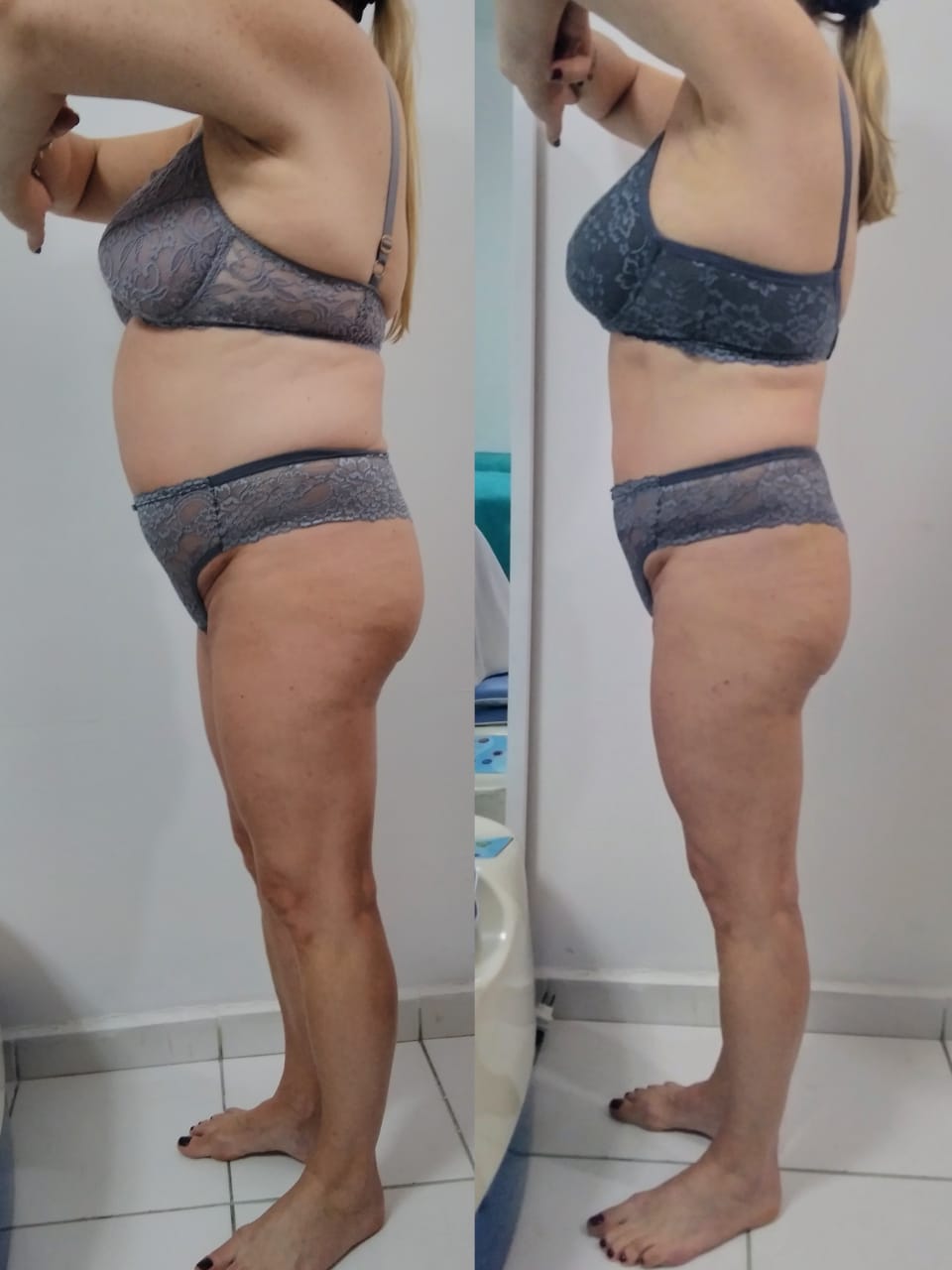 Antes e depois — Silhueta mais alinhada
